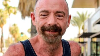 Timothy Ray Brown, conhecido como ‘paciente de Berlim’, lutava contra a leucemia (AML)