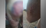 Soldado do Exército ficou com hematomas após ser agredido por colegas em quartel em SP