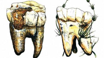 Estudo descobriu a dieta de sete indivíduos australopitecos da África do Sul, que viveram de 3,7 a 3,3 milhões de anos atrás