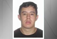 Escrivão de polícia morre após realizar transplante capilar em São Paulo